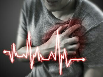 Serangan Jantung